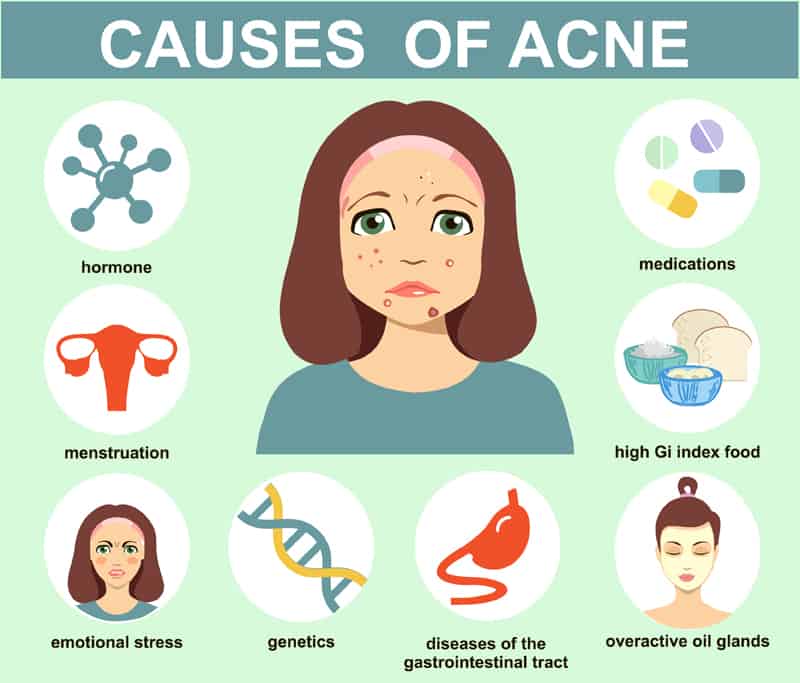 Let s Talk Skin Acne Blackheads Blog Vie Aesthetics let-s-talk-skin-acne-blackheads-blog-vie-aesthetics