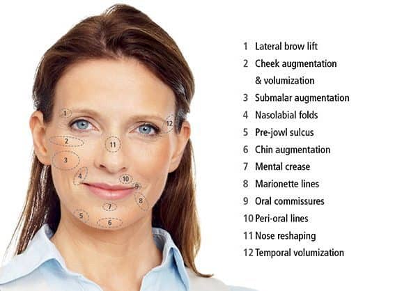 Diagram showing how the Ellanse dermal filler reverses ageing