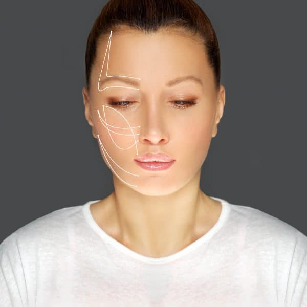 Woman showing the benefits of the Silhouette Soft thread lift