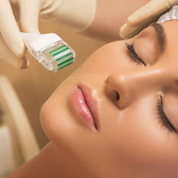 woman has skin rejuvenation treatment with the dermapen or dermaroller