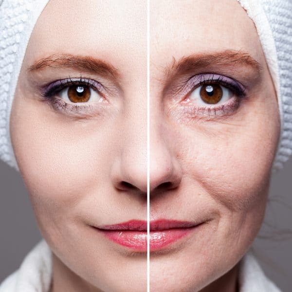 Woman showing the benefits of the SSR super skin rejuvenation treatment