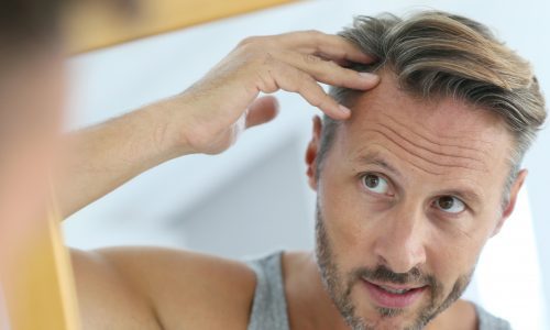 Seven things you wish you knew about hair transplants