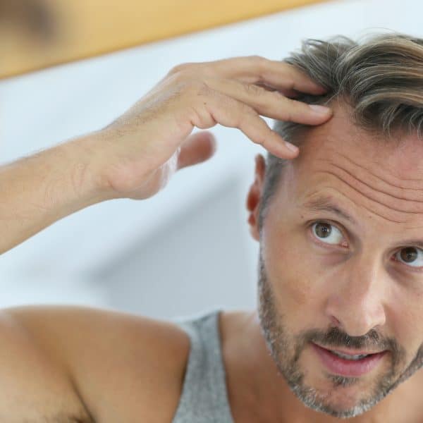 Man with hair loss worries considers VieStem Hair with Regenera Activa treatment