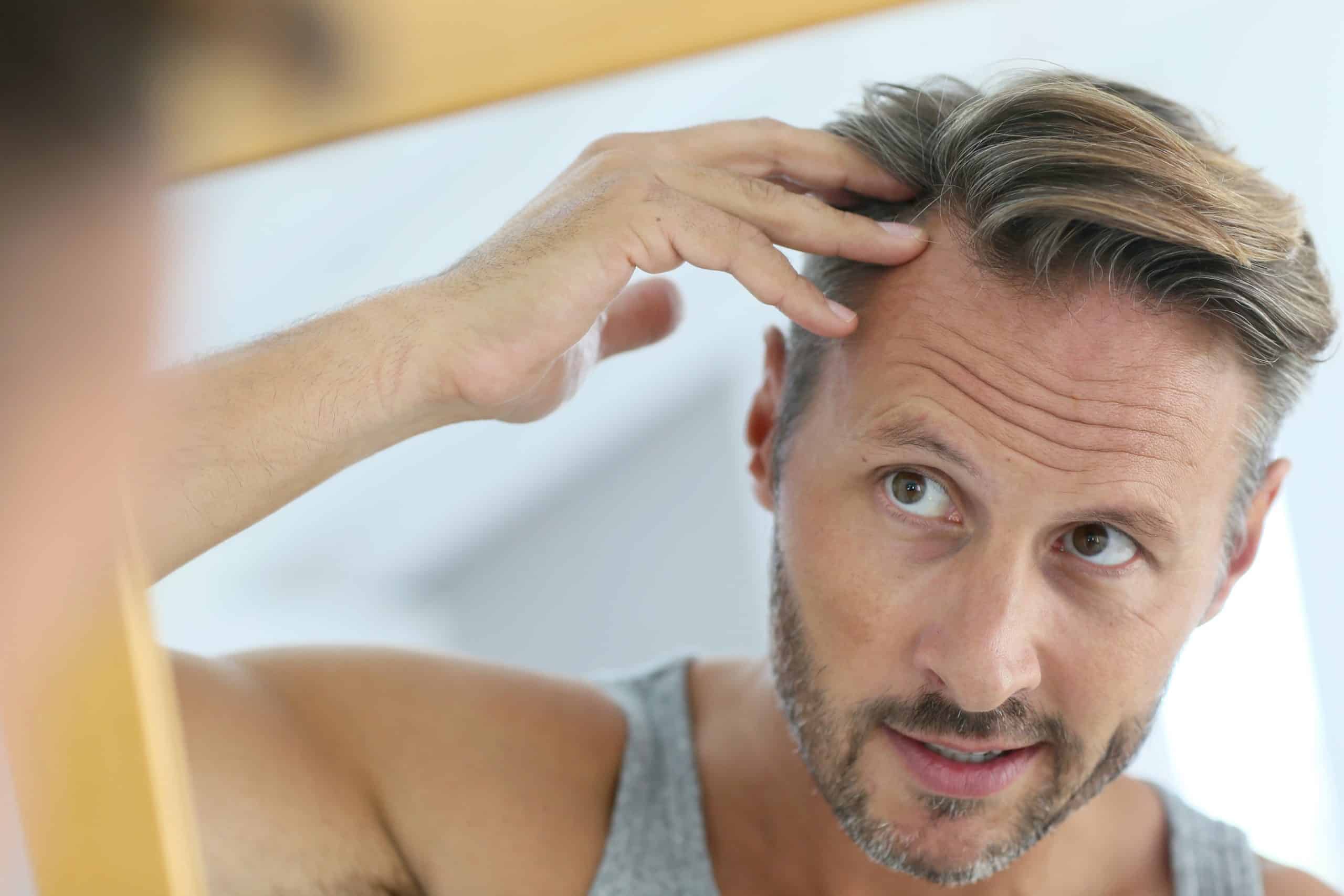 Seven things you wish you knew about hair transplants