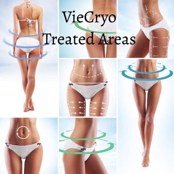 A woman shows the different body areas that can be treated by VieCryo fat freezing