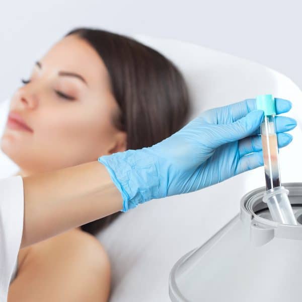 Woman having PRP (platelet-rich plasma) therapy, aka vampire facelift, for anti-ageing