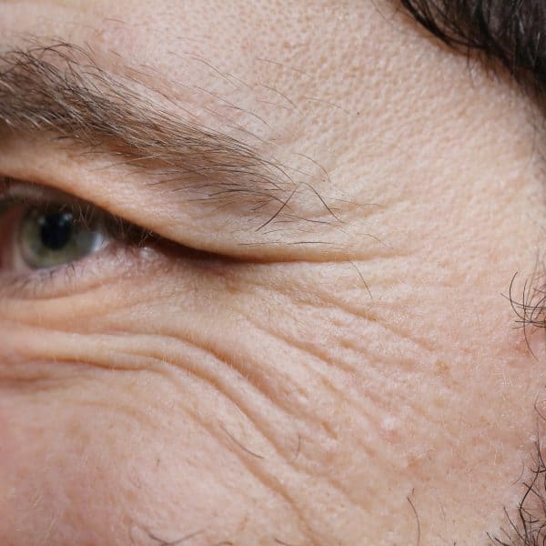 Crow's feet on a man caused by ageing or lifestyle