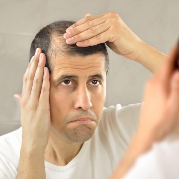 man considering non-surgical treatments for hair loss