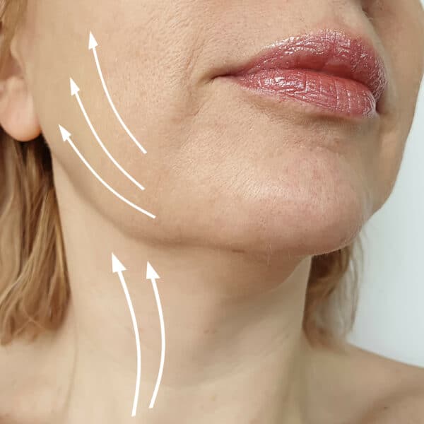 woman with jowls considers a non-surgical skin tightening procedure