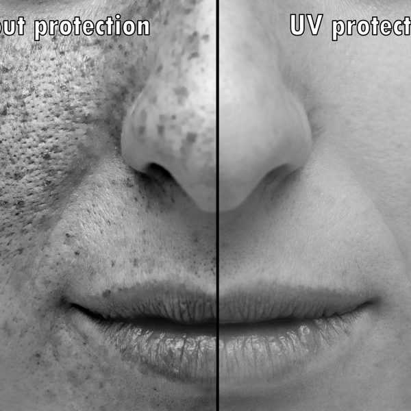 what sun damaged skin looks like in comparison to protected skin