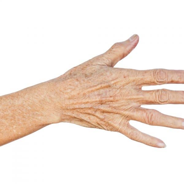 Ageing Hands