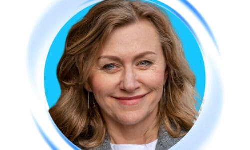 VieLift vs. Facelift for Your Party Season  Rejuvenation?