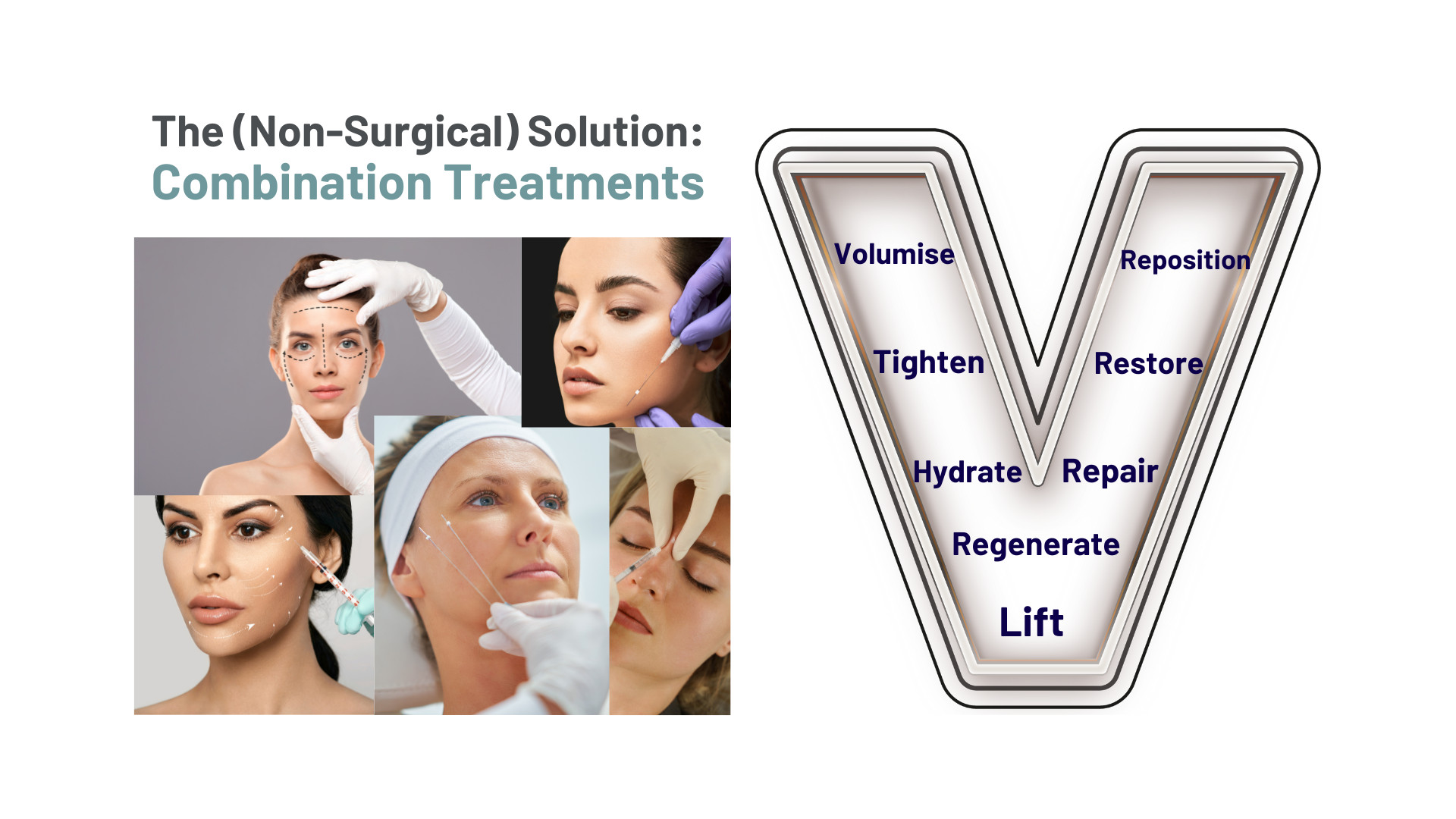 The VIElift at Vie Aesthetics London and Essex
