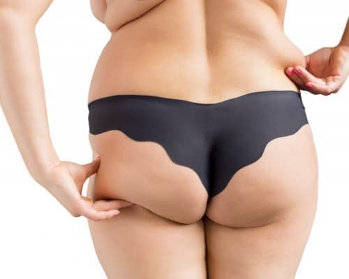 Body Concerns