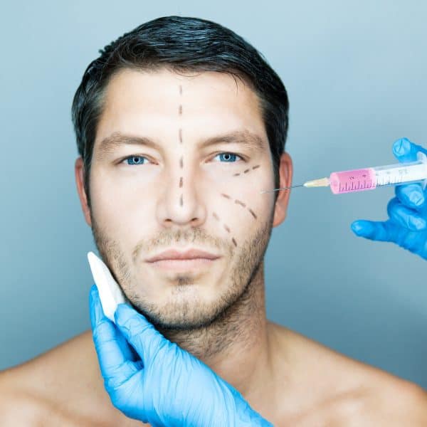 Thirty something male receiving dermal filler and liquid facelift injections