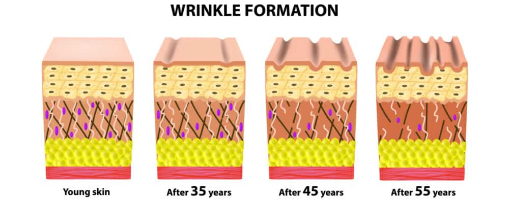 diagram showing wrinkle formation in skin of different ages