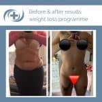 Woman shows weight loss results from the national medical weight loss programme