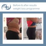 weight loss results of the national medical weight loss programme