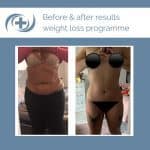 Before and After results of the national medical weight loss programme