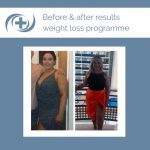 Before and After of the national medical weight loss programme