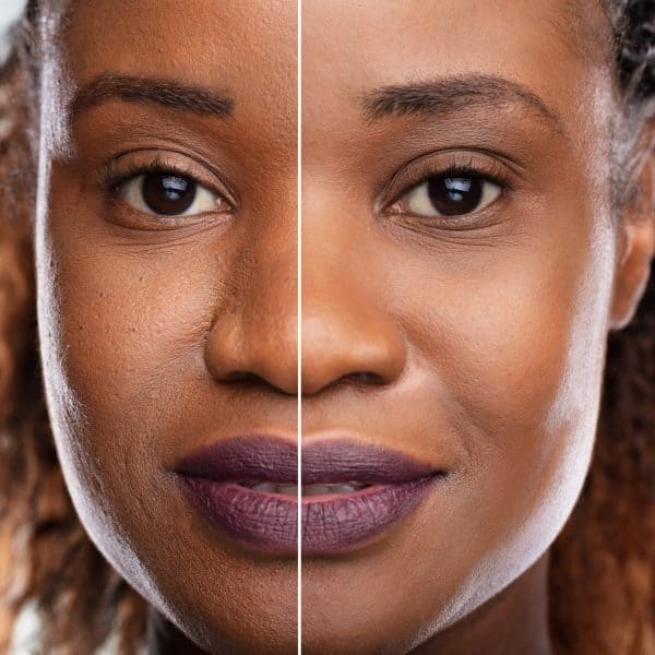 young black woman before/after of anti-ageing skin treatments