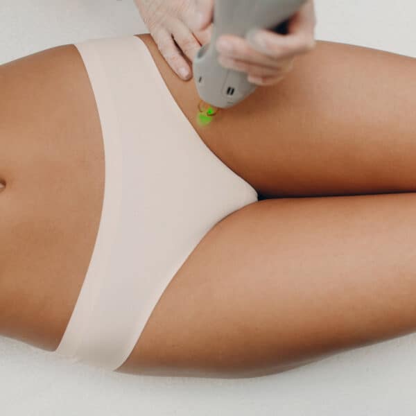 diolaze laser hair removal areas image vie aesthetics