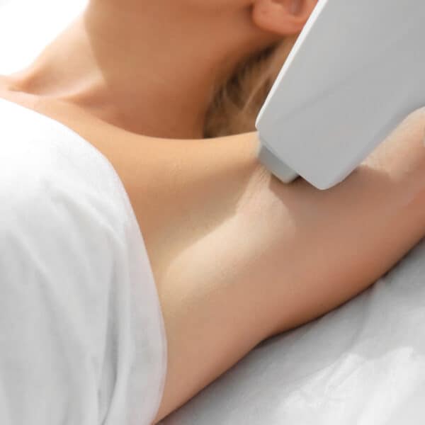 diolaze laser hair removal gallery image vie aesthetics