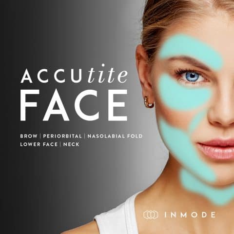 AccuTite™ Skin Tightening