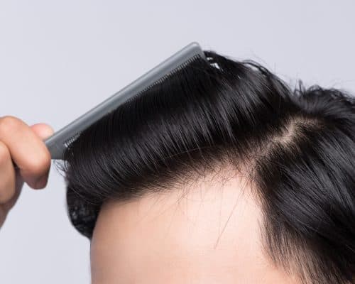 Hair Loss Products