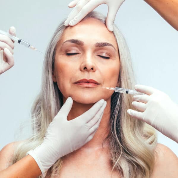 senior lady for dermal fillers and anti wrinkle at vie aesthetics