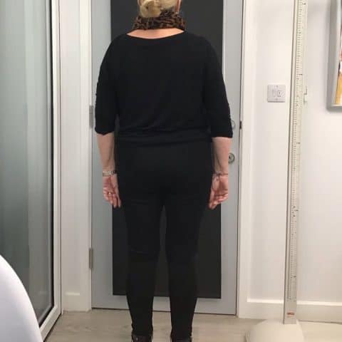 medical weight loss clinic case study before photo