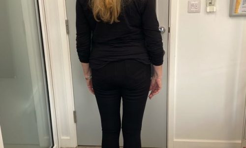 Linda’s Case Study for Weight Loss