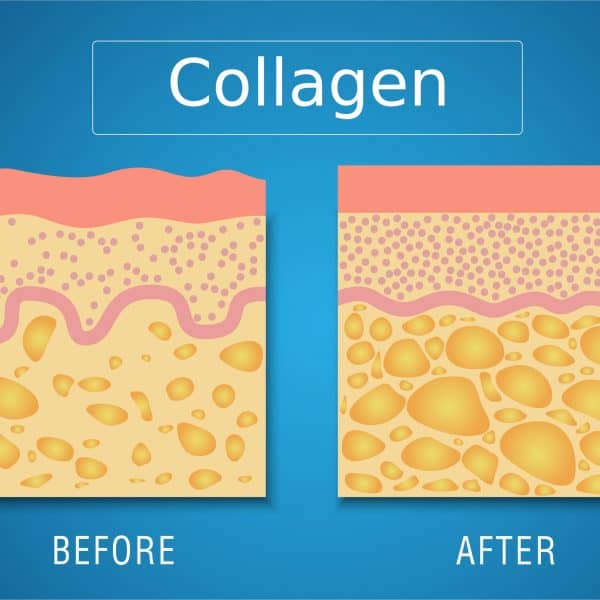 diagram showing effects of lanluma collagen stimulant on the skin