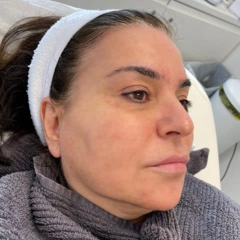 Woman shows off glowing, smooth skin after having the DIBI Gold Leaf Facial skincare treatment at Vie Aesthetics