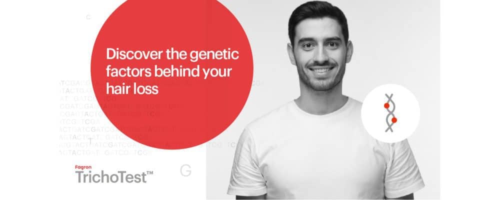 discover the genetic factors behind your hairloss with dna testing