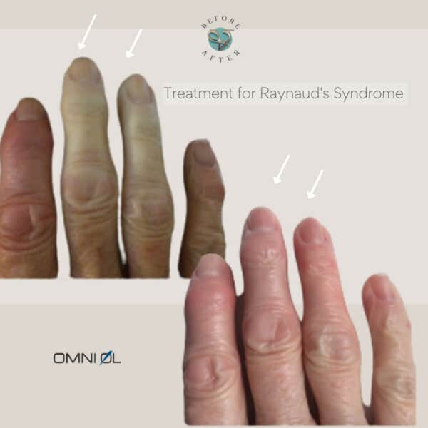 before and after omni oil