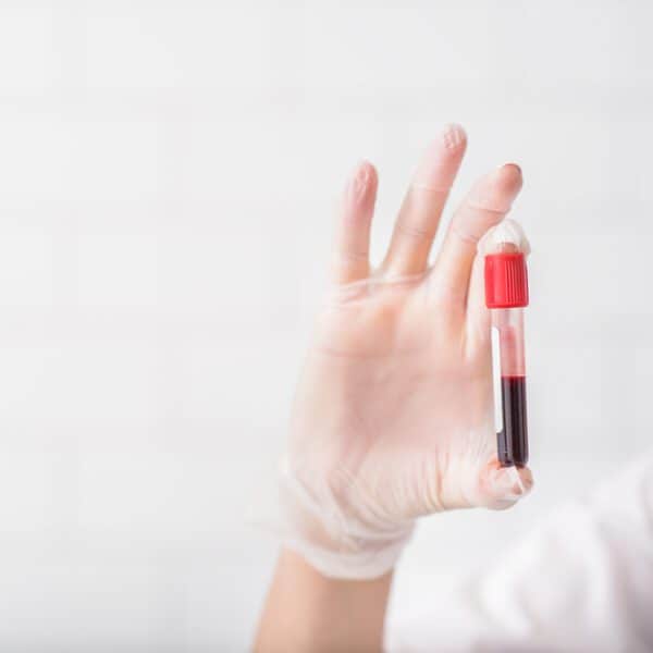 blood testing image vie aesthetics