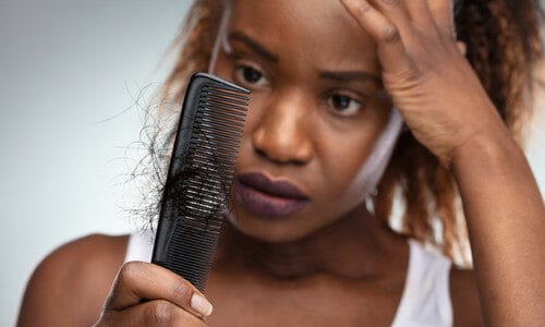 Treatments For Hair Loss That May Actually Work