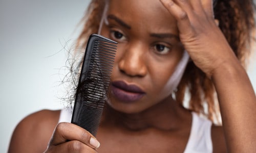 Treatments For Hair Loss That May Actually Work