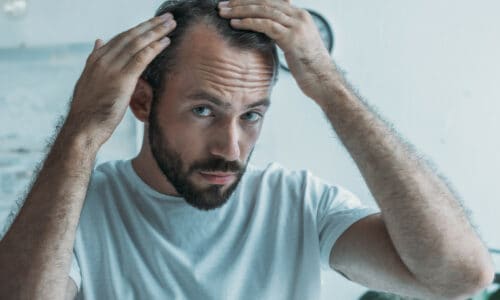 August Is National Hair Loss Awareness Month