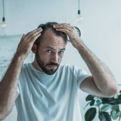 August Is National Hair Loss Awareness Month