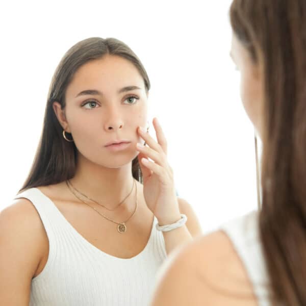 Acne Anxiety: What Is The Best Treatment?