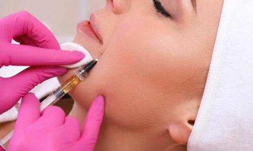 The Benefits of Mesotherapy for Skincare