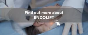 endolift non surgical jowls lift essex london