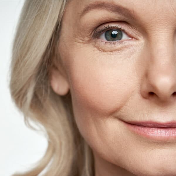 non surgical jowl lift treatment endolift london essex