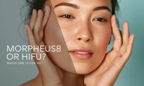 Morpheus8 vs HIFU: Which one is right for me?