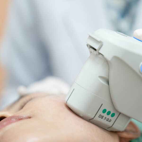 hifu skin tightening in essex image vie aesthetics