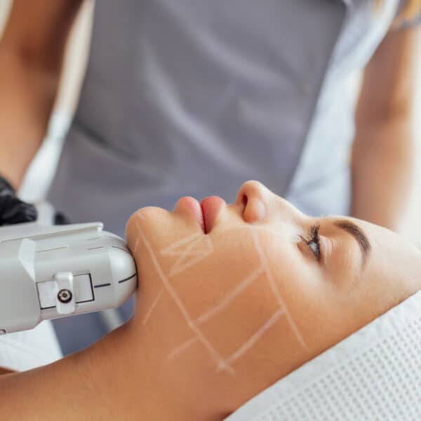 HIFU Skin tightening in london image vie aesthetics