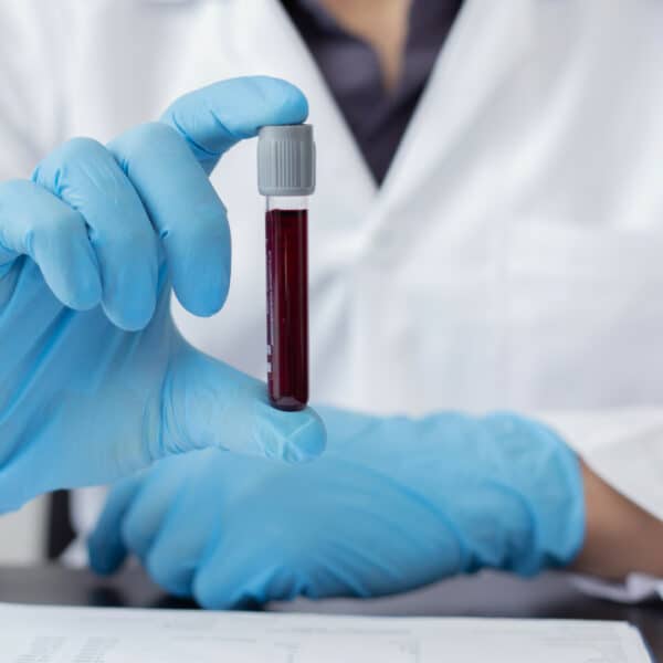blood testing in essex image gallery vie aesthetics