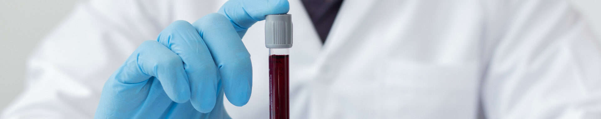 blood testing in london vie aesthetics banner image